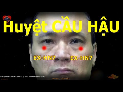 EX-HN7 | Huyệt Cầu hậu | Huyệt ngoài kinh | Acupoint VIKUDO