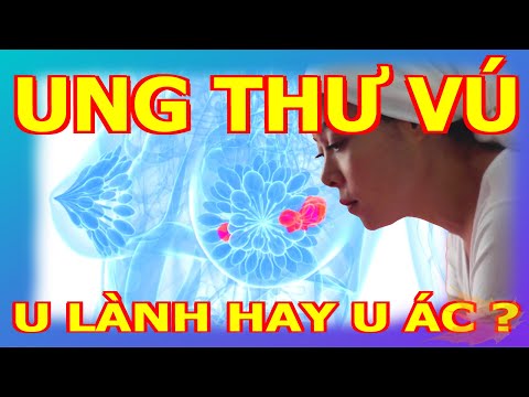 Life V20 | Ung thư vú | U lành hay u ác ? | Ăn uống lành mạnh | Bệnh tật | Life V