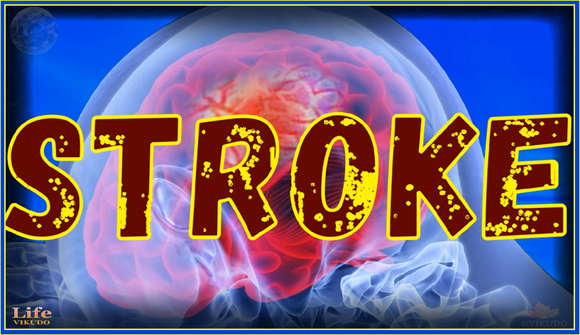 Life 74 _ Stroke _ Causes, signs, prevent and treat